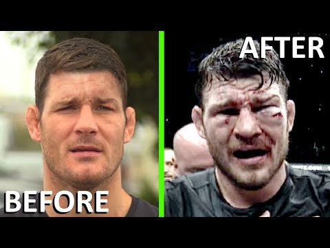 Michael Bisping COMPLETE LOSSES in UFC Fights (NEW)